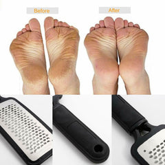 Foot Rasp File Callus Remover Pedicure Tool