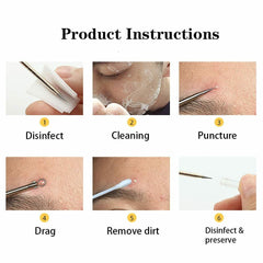 Ear Wax pimple And Blackhead Remover - COMBO tool KIT