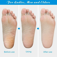 Foot Rasp File Callus Remover Pedicure Tool